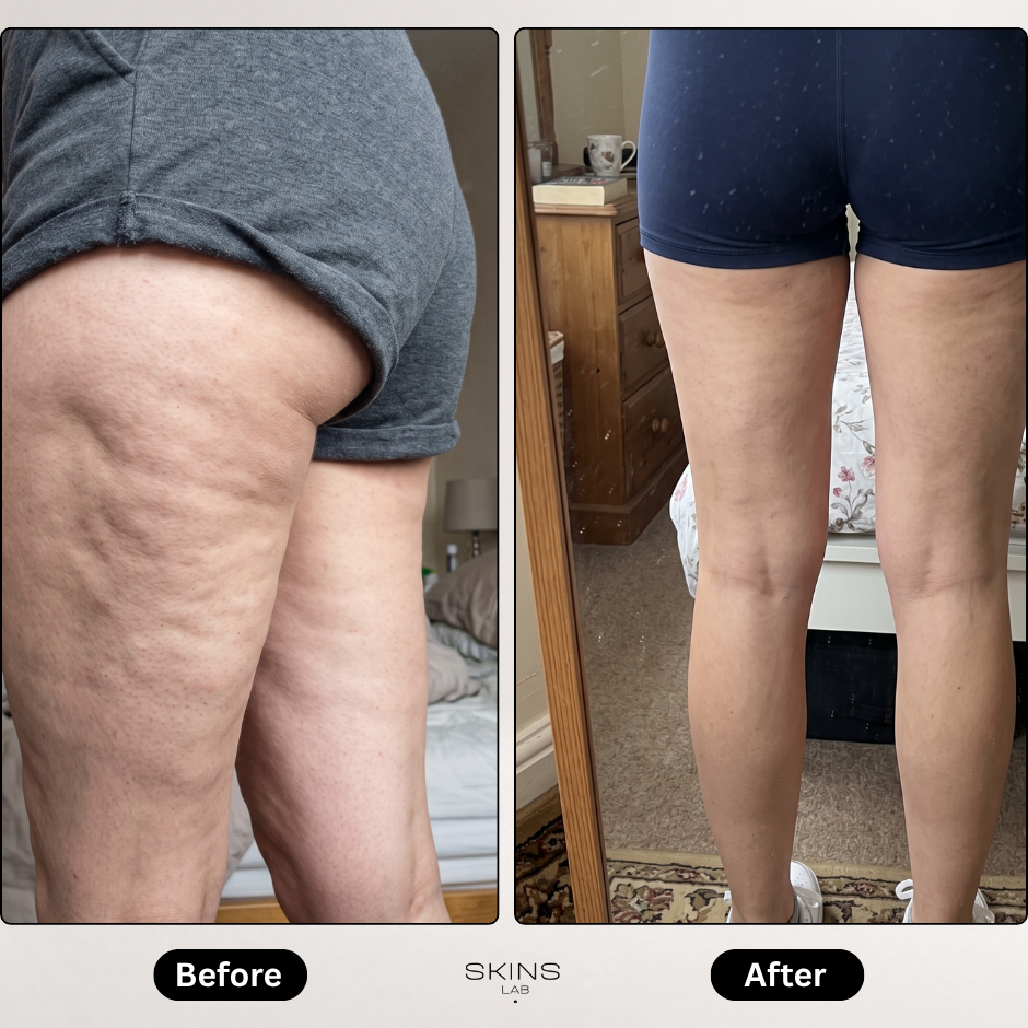 Skin Revive Pro
