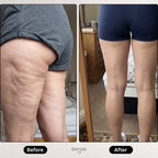 Skin Revive Pro