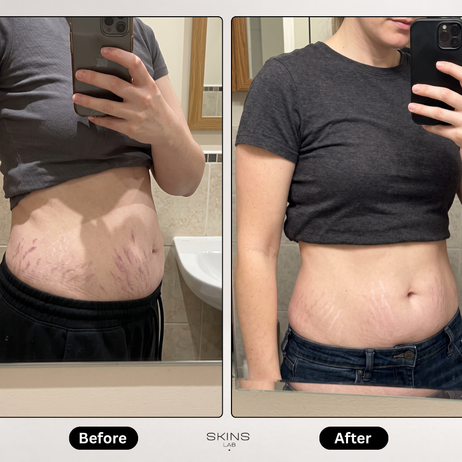 Skin Revive Pro